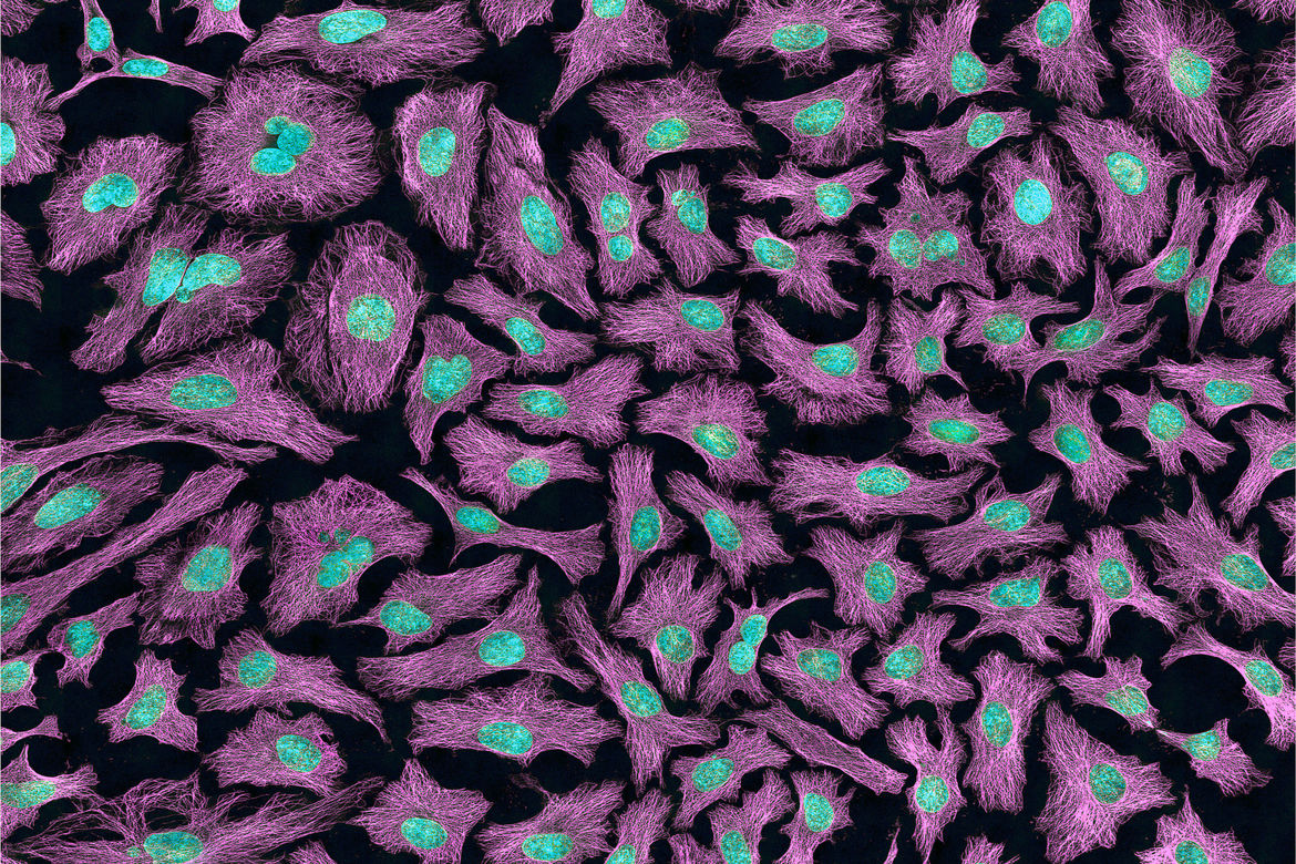 Multiphoton fluorescence image of HeLa cells with cytoskeletal microtubules (magenta) and DNA (cyan)
