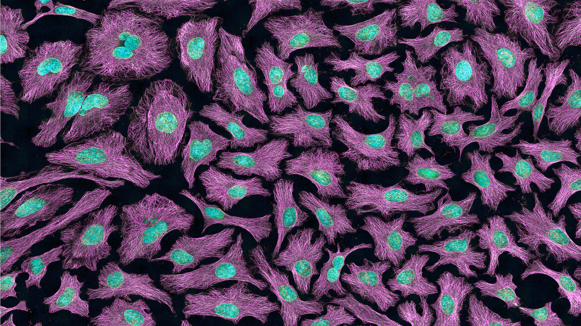 Multiphoton fluorescence image of HeLa cells with cytoskeletal microtubules (magenta) and DNA (cyan)